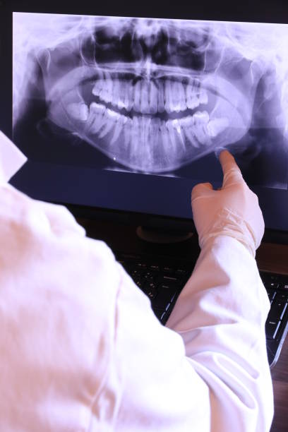 Best Emergency Dental Care for Sports Injuries in Rhinelander, WI