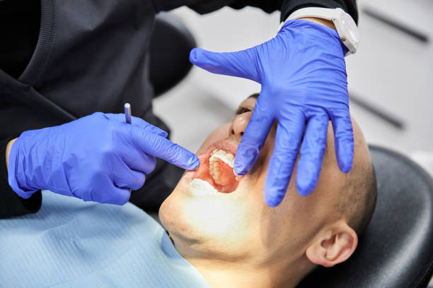 Best Knocked-Out Tooth (Avulsed Tooth) Treatment in Rhinelander, WI